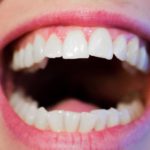 Zdrowe i mocne zęby bez próchnicy – zadbaj o nie już teraz. Próchnica i ból zębów – leczenie ,a także profilaktyka